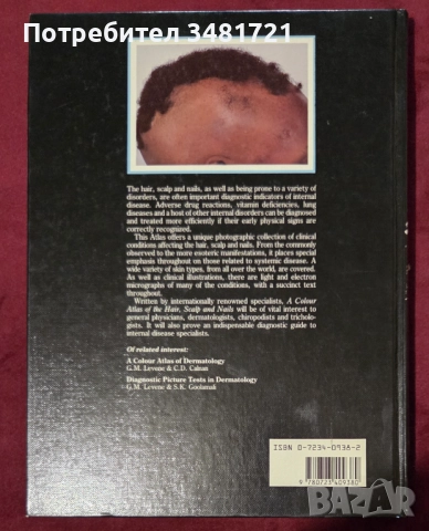 A Colour Atlas of the Hair, Scalp and Nails, снимка 15 - Специализирана литература - 52539726