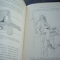Медицинска книга Изследване на уринарната система, 1909 , френска, снимка 13 - Специализирана литература - 33406019