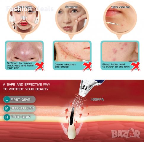 Вакуум за премахване на черни точки Инструмент за почистване на порите, снимка 7 - Други - 33620505