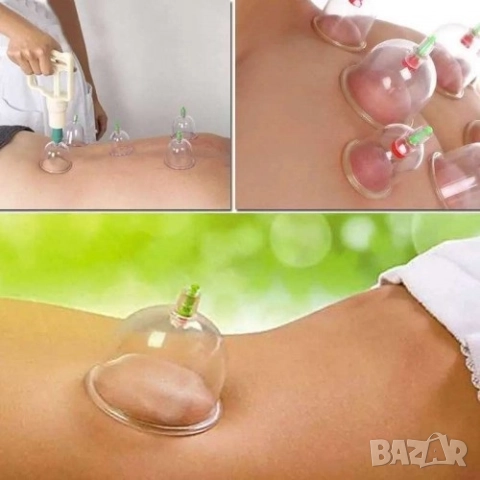 Комплект Автоматични Вендузи 6 бр. за козметичен и медицински масаж, снимка 2 - Други - 51887643