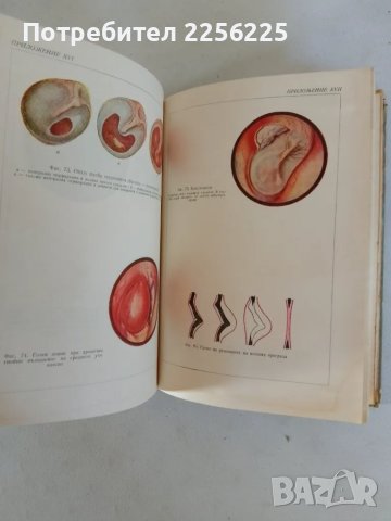 Учебник по ушни, носни и гърлени болести , снимка 6 - Специализирана литература - 47482824