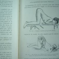 Медицинска книга Изследване на уринарната система, 1909 , френска, снимка 16 - Специализирана литература - 33406019
