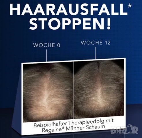 Regaine/Rogaine Minoxidil Пяна която подпомага разтежа на коса и брада, снимка 4 - Продукти за коса - 33410711