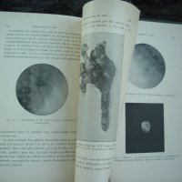 Медицинска книга Изследване на уринарната система, 1909 , френска, снимка 14 - Специализирана литература - 33406019