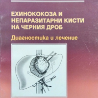 Ехинококоза и непаразитни кисти на черния дроб. В. Тасев 2000 г., снимка 1 - Специализирана литература - 36556471