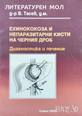 Ехинококоза и непаразитни кисти на черния дроб. В. Тасев 2000 г.