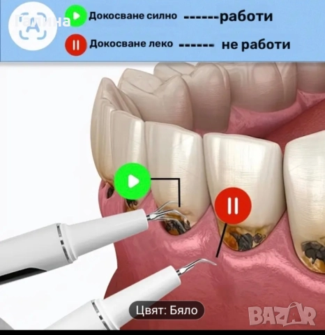 Машинка за почистване зъбен камък с ултразвук, снимка 10 - Други - 51982486