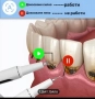 Машинка за почистване зъбен камък с ултразвук, снимка 10