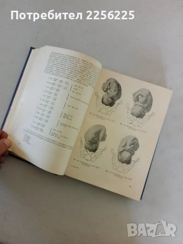 Физиология на бременността , снимка 7 - Специализирана литература - 47618639
