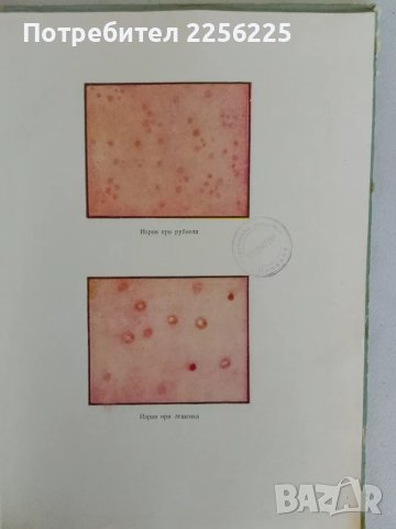 "Заразни болести", снимка 3 - Специализирана литература - 47481876