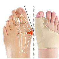 Коригиращи ортопедични чорапи за палеца на крака, снимка 1 - Други - 43121176