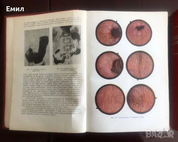 1 и 2 Том Вътрешни болести от К.Чилов. Т.Ташев М.Рашев от 1955 год. С твърди корици, снимка 3 - Специализирана литература - 48577774
