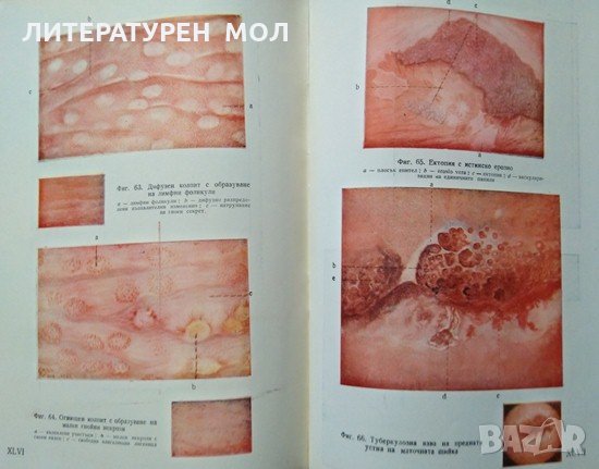 Ранна диагностика и профилактика на рака на женските полови органи. 1955 г., снимка 2 - Специализирана литература - 27589697