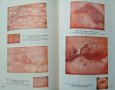 Ранна диагностика и профилактика на рака на женските полови органи. 1955 г., снимка 2